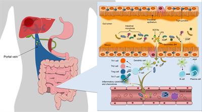 The Role of Gut Microbiota in Some Liver Diseases: From an Immunological Perspective